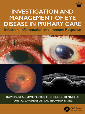 [Kép: Investigation-Management-Of-Eye-Disease-...sponse.jpg]