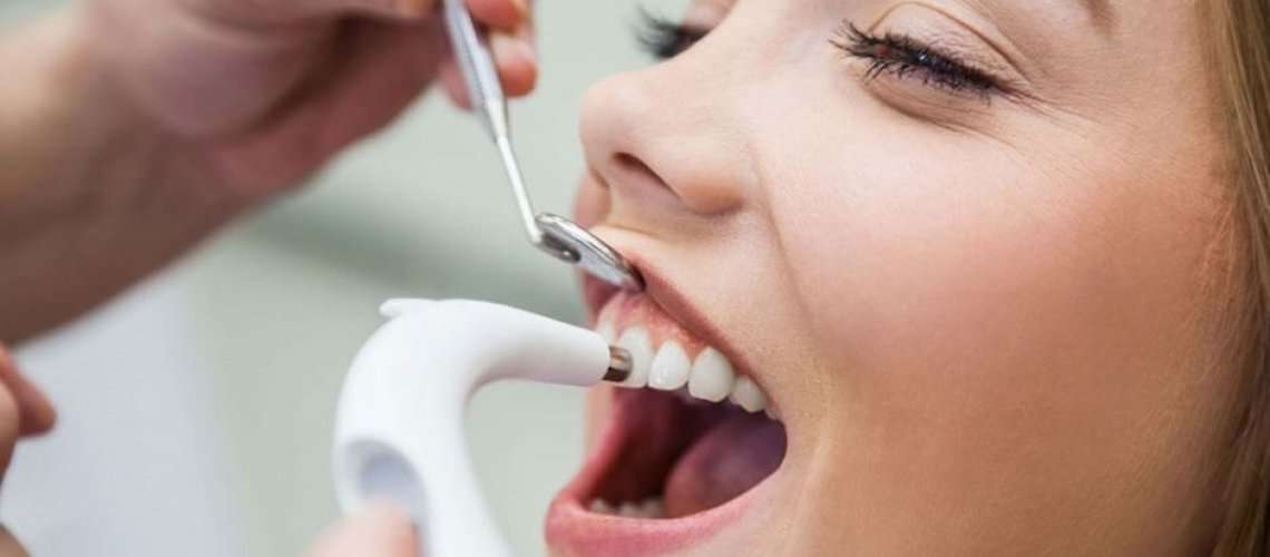Post-Cleaning Care: Does Scaling Whiten Teeth and How to Keep Them That Way