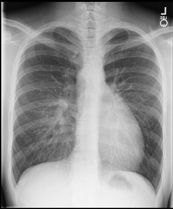 Pediatrics question 1 image
