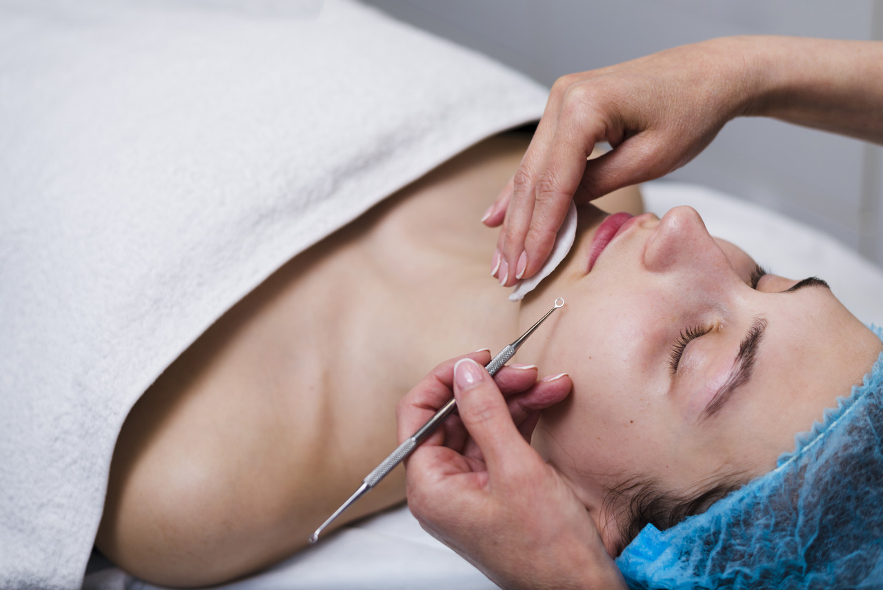 Cosmetic Facial Acupuncture