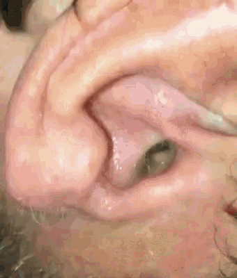 519-C5-E43-4883-4-E06-8397-C1-C16-C30-D22-B.gif