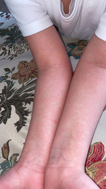 778E9A11-7866-4BF4-947B-A6860BB86403