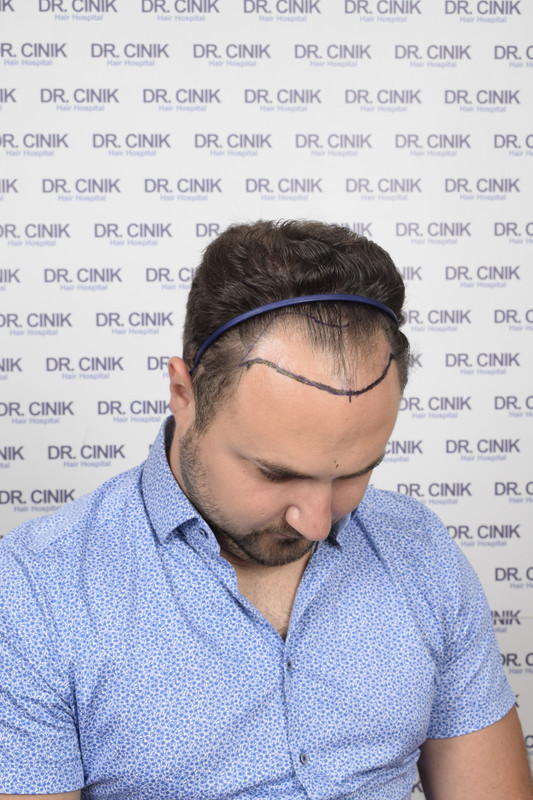 photos préopératoires (4)