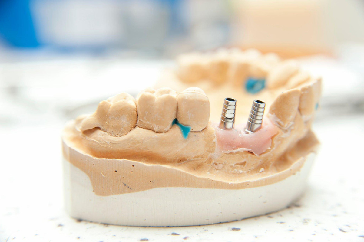dentist Tucson