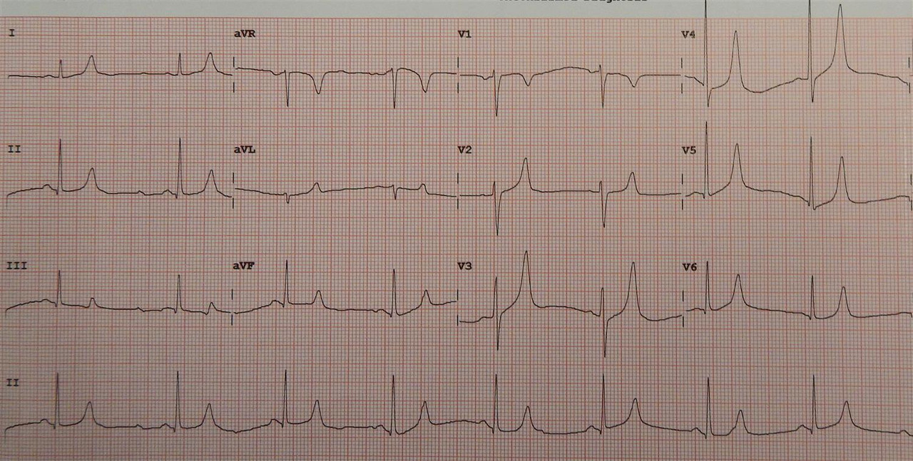 Orthopedics question 4 image