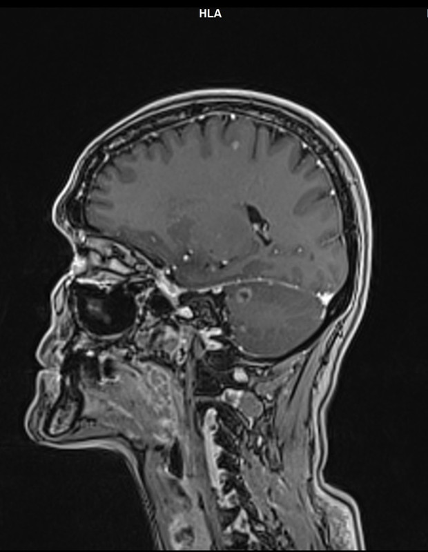 63E4B57B-1900-46F8-9053-51FFB9E7C615