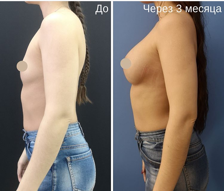 6291917A-C4DA-491B-B7E4-A574FEA28C1C