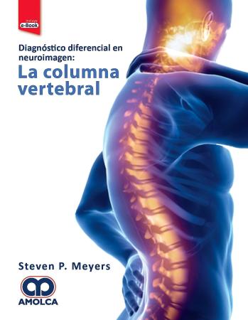 Portada de Diagnóstico diferencial en neuroimagen: La columna vertebral