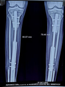 IMG-20221107-040218