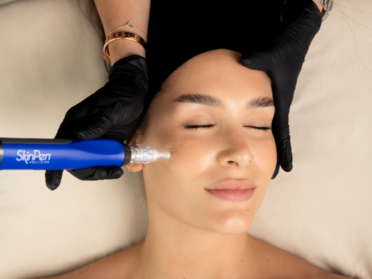 SkinPen microneedling at Let's Face It Med Spa in Denver.
