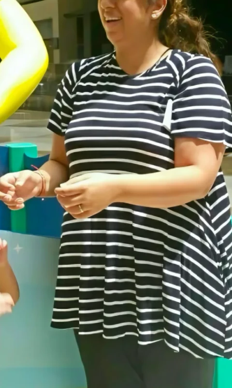 Patient before weight loss