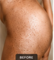 Skin Before Treatment