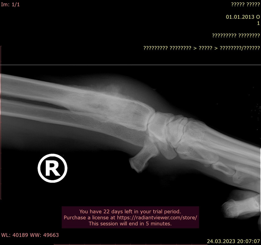 лашко шейла 1