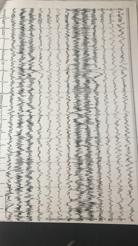 659D5454-9972-4194-BC71-A8E9E0E59F2B