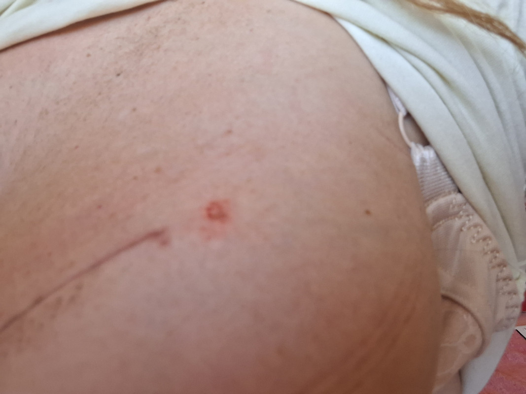 17514482989976642110475599340605