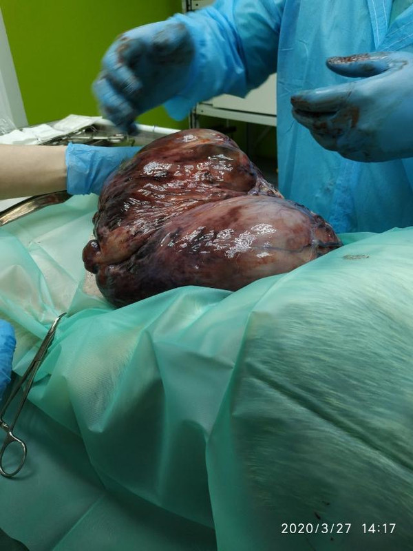 4FAD4705-4792-45E6-8D54-A6BBA84EB629