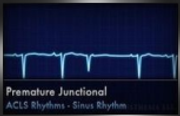 premature junctional