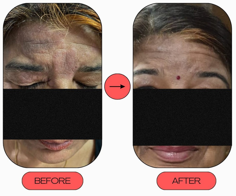 Dermatitis treatment before and after