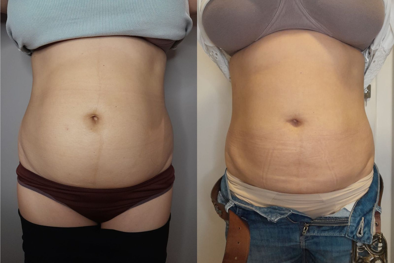 Projeto 8