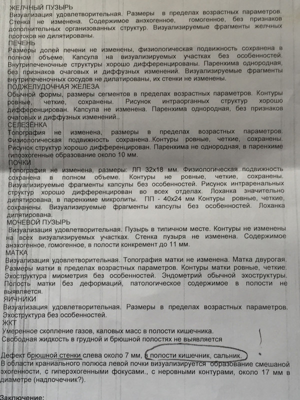 92E38F1B-D059-49F8-8000-28167F956420