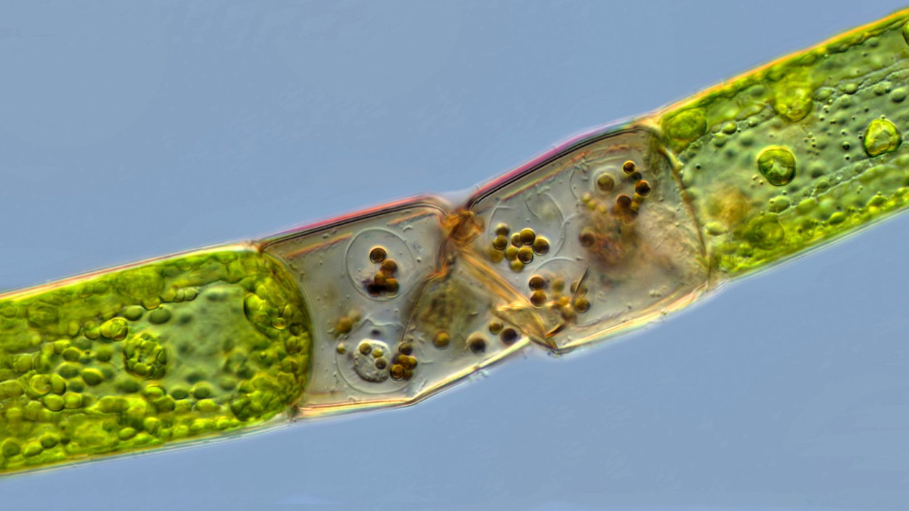 Oedogonium 22 Kappen Männl Zoosporen (Spermien) oder Parasiten DIK 100 Stack 2