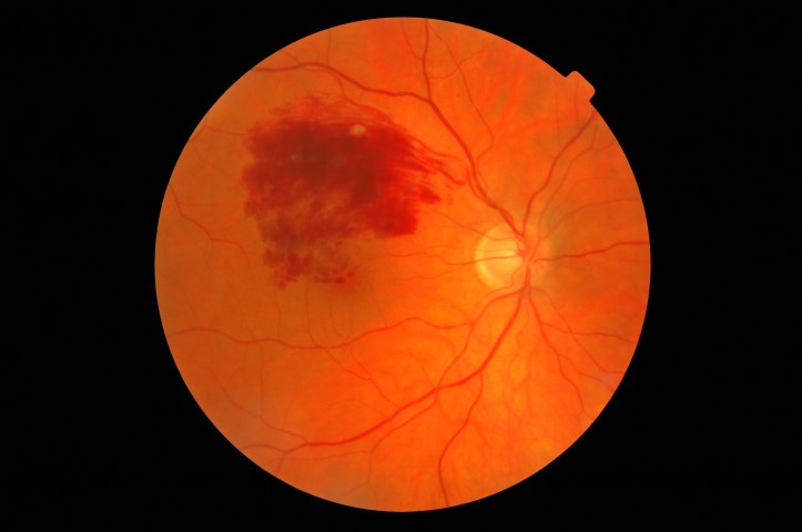 0KENFGCU111RJGFZ__00 (Small)