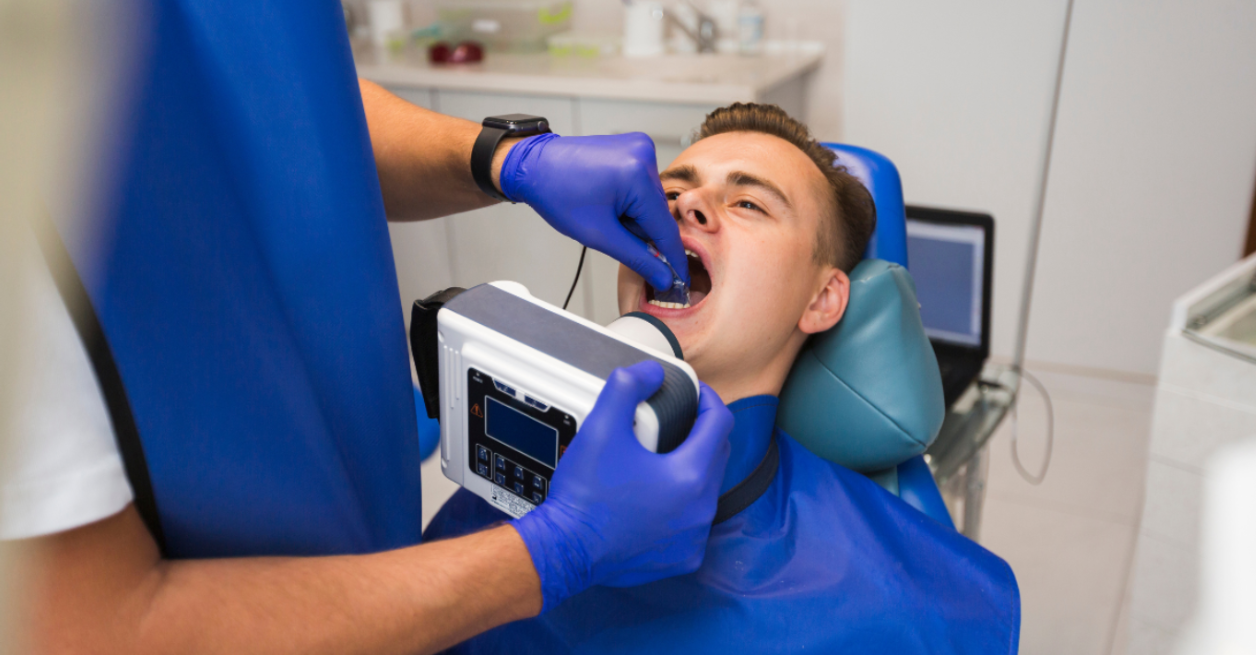 5 facts you need to know about teeth whitening