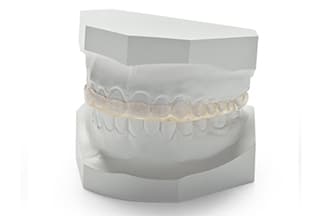 Night Guards / Bruxism Splints