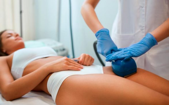 HIFU body sculpting