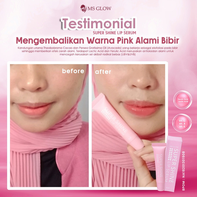 testimoni ms glow skin care