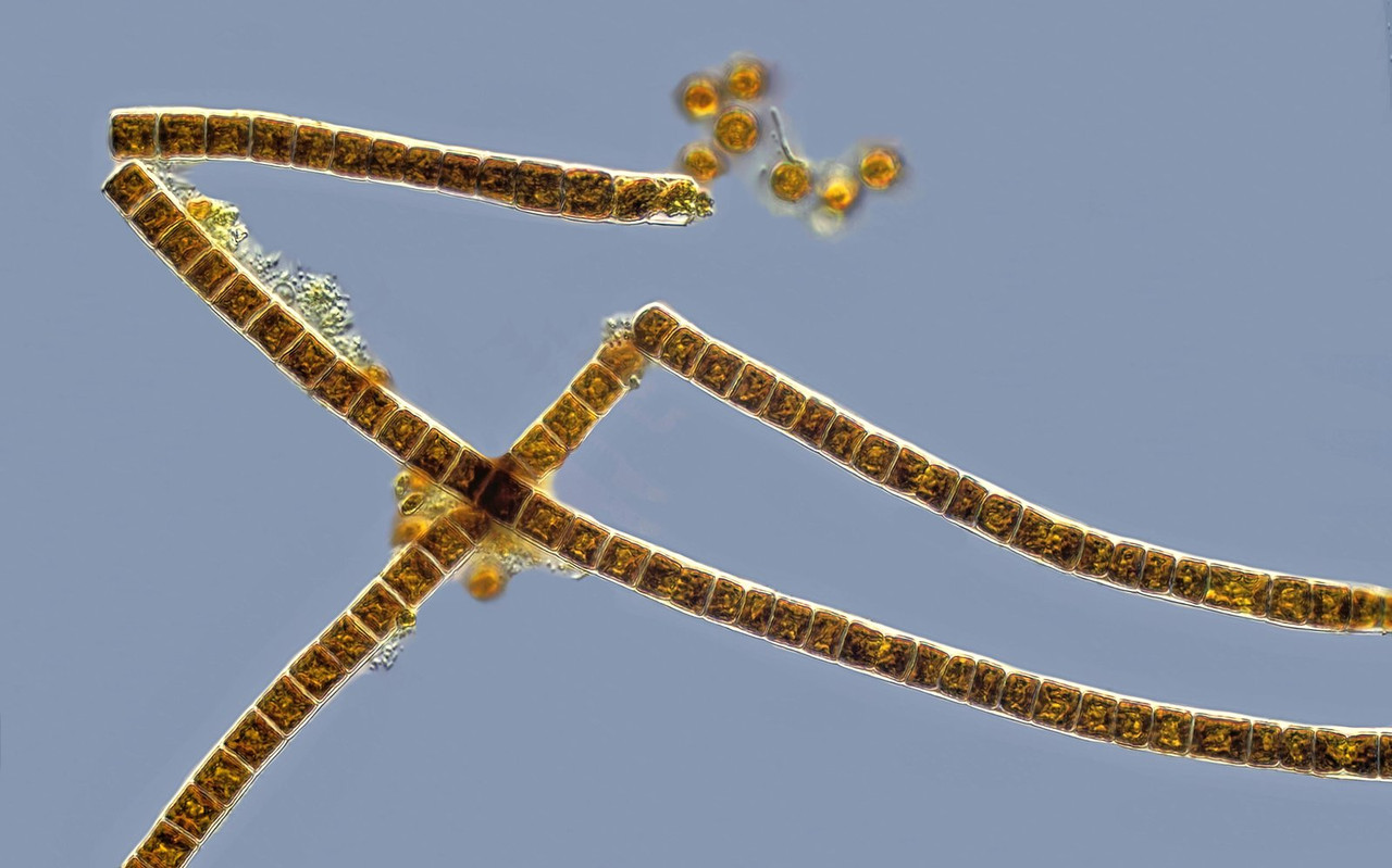 Microspora 20 (ev) floccosa oder wittrockii Doppelbecher-Alge Lugol-Stärkenachweis positiv DIK 50