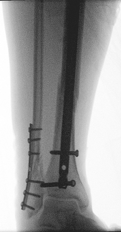 19 12 25 t standard 2