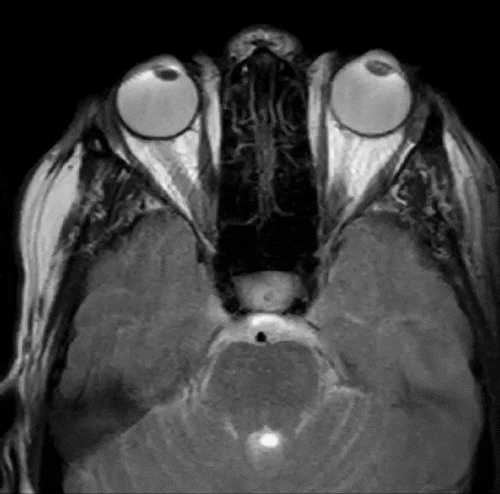 GIFs-13