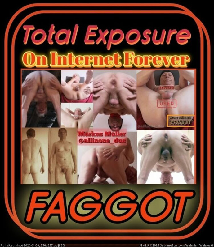 exp total exposure fggt allinone dus