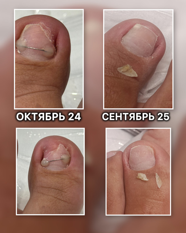 подология 9