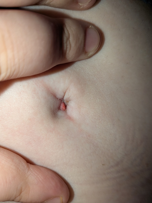 PXL 20251128 052236381 MACRO FOCUS