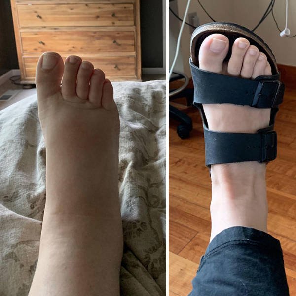 comparison-34