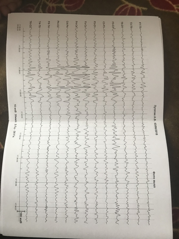 795D4A5B-CA84-4090-B161-C6E85B706458