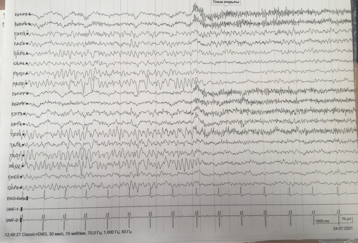 12A410A7-4637-46D9-ADA7-60A031AB20CE