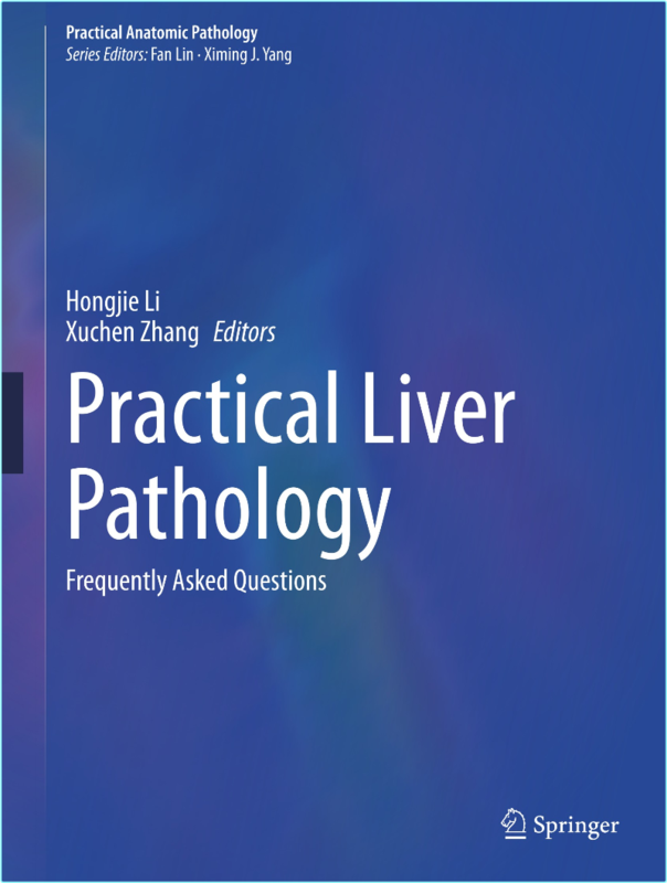 [Image: xb497hkob4ps.png]