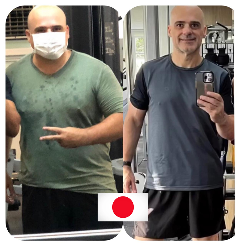 Antes e Depois - Depoimento 5