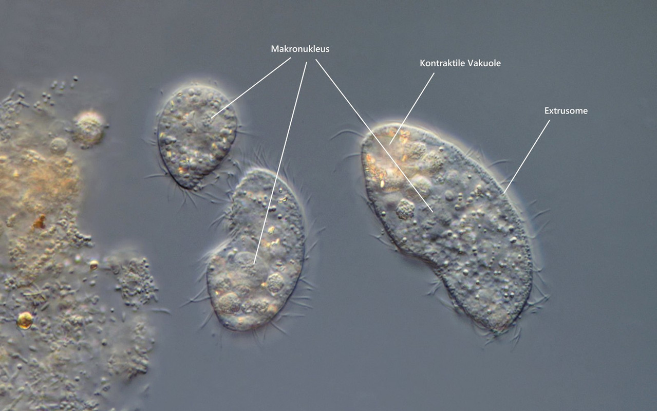 Colpoda 11 inflata Heutier Mundfeld Extrusome Makronukleus mit aufgewickelter DNA (Körner) DIK 100-Z