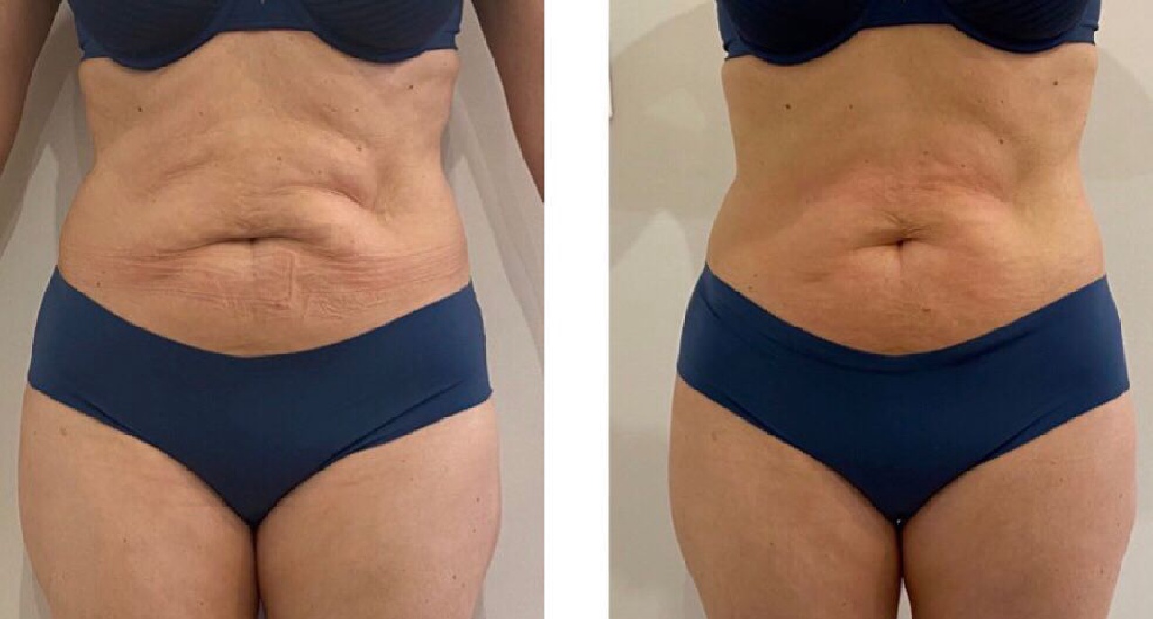 Projeto 5