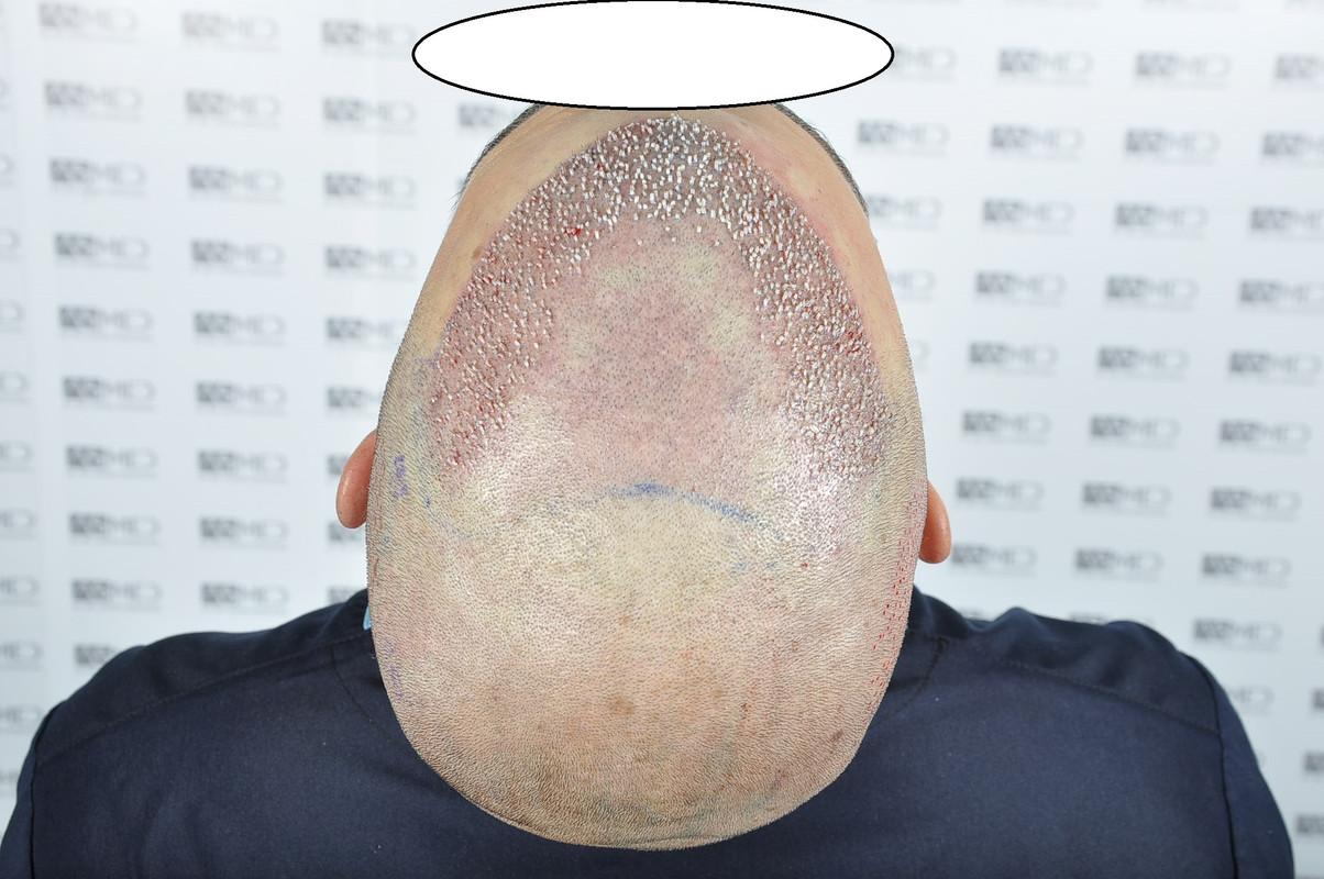 21 O2