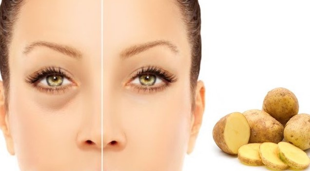 devojka i krompir protiv podočnjaka