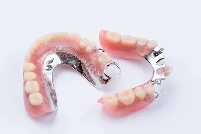 Cast Partial Dentures