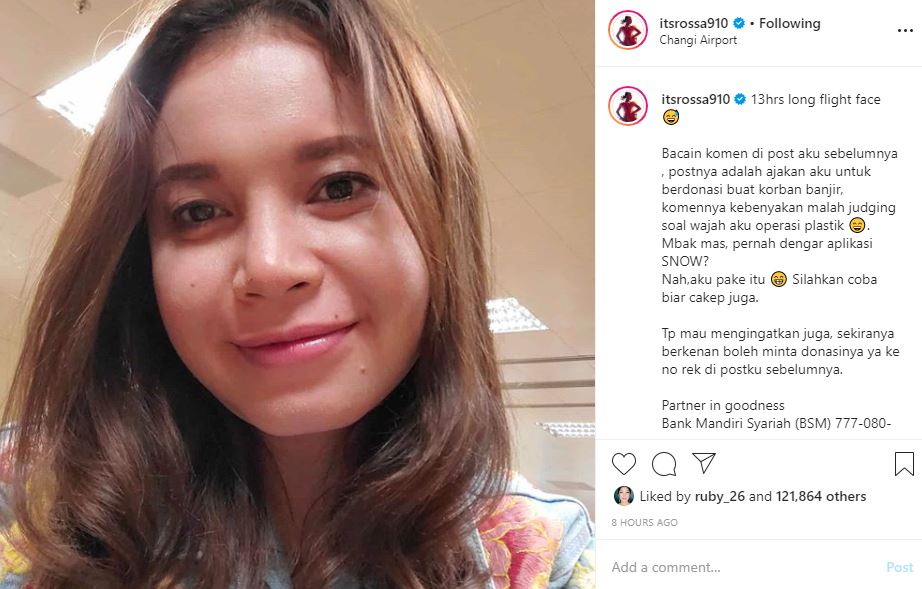 Rossa membantah tudingan operasi plastik