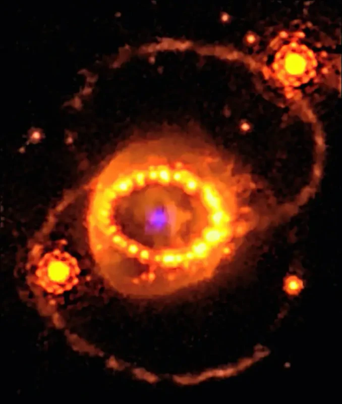 sn-1987A