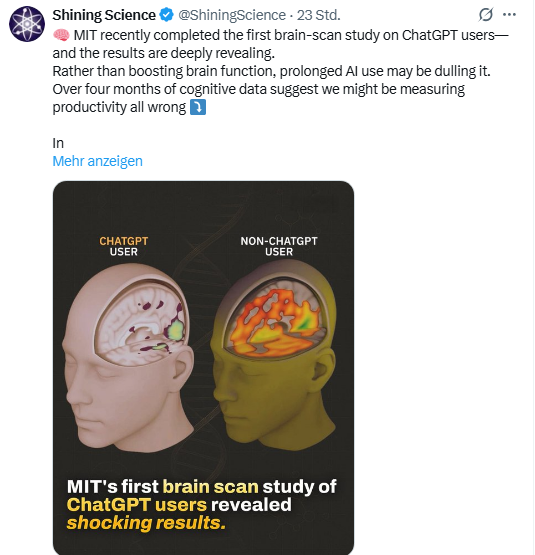 MIT ChatGPT Gehirn-Studie