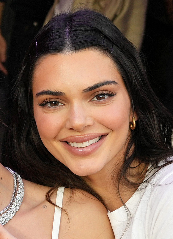 Evolución de los labios de Kendall Jenner a lo largo de los años